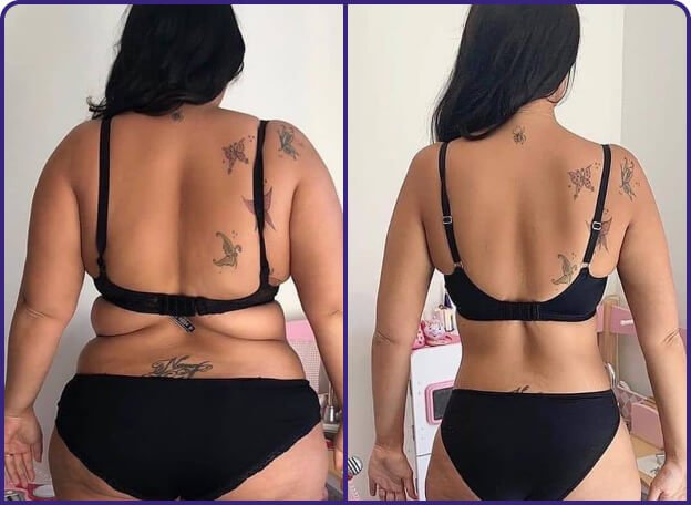 Female customer transformation image used in 21 Keto Gummies marketing