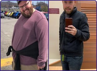 Male customer transformation image used in 21 Keto Gummies marketing